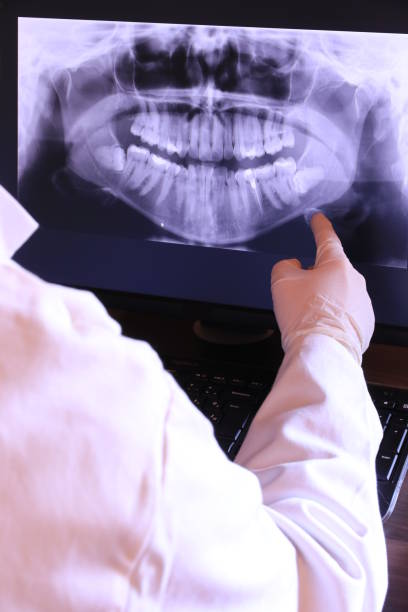 Best Emergency Dental Extractions in Kahoka, MO