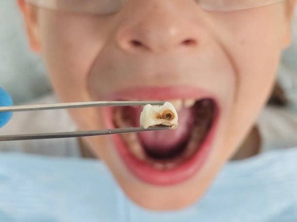 Best Pediatric Emergency Dentist in Kahoka, MO